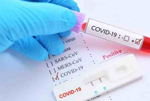 Apakah Rapid Test Covid-19 Dicover BPJS Kesehatan?